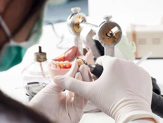 Becoming a Dental Lab Technician A Comprehensive Guide