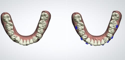 Model Before/After