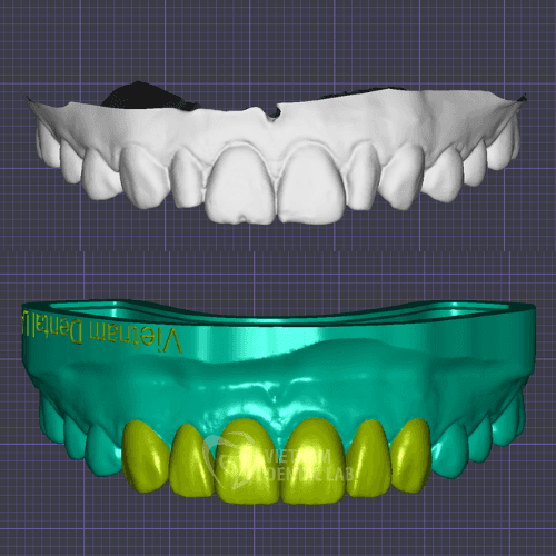 Waxup Model