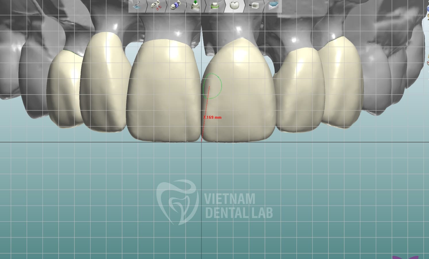 Slide 6