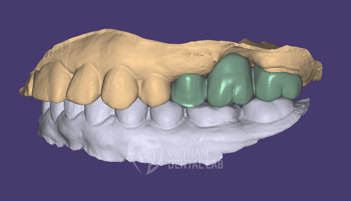 Slide 2