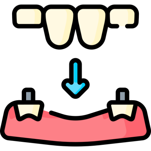 bridges - About Us - Vietnam Dental Lab