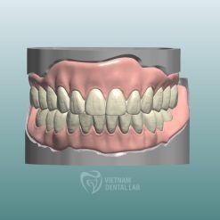 - Vietnam Dental Lab Bite Adjustment