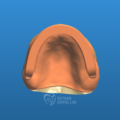 - - Vietnam Dental Lab