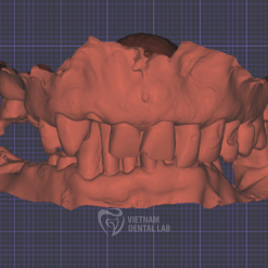 - - Vietnam Dental Lab