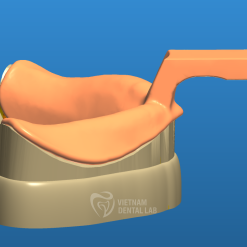 - - Vietnam Dental Lab