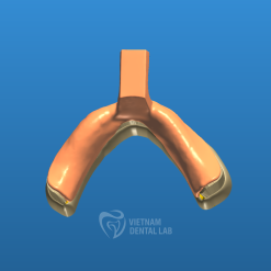 - Vietnam Dental Lab Denture Impression Trays