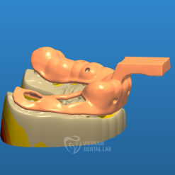 - - Vietnam Dental Lab