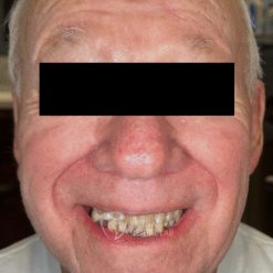 - - Vietnam Dental Lab