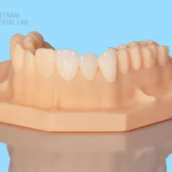 e.max®