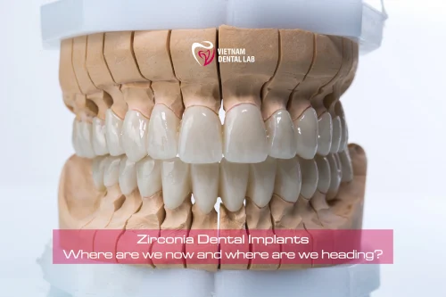 - - Vietnam Dental Lab