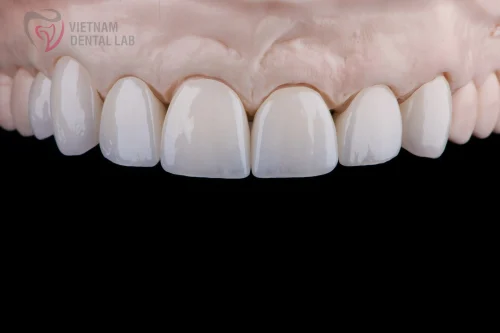 - - Vietnam Dental Lab